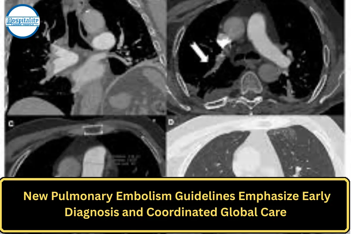New Pulmonary Embolism Guidelines Emphasize Early Diagnosis and Coordinated Global Care