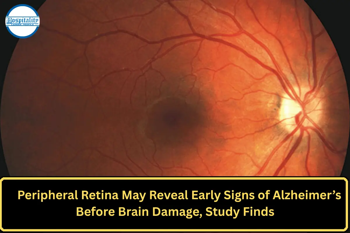 Peripheral Retina May Reveal Early Signs of Alzheimer’s Before Brain Damage, Study Finds