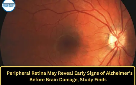 Peripheral Retina May Reveal Early Signs of Alzheimer’s Before Brain Damage, Study Finds