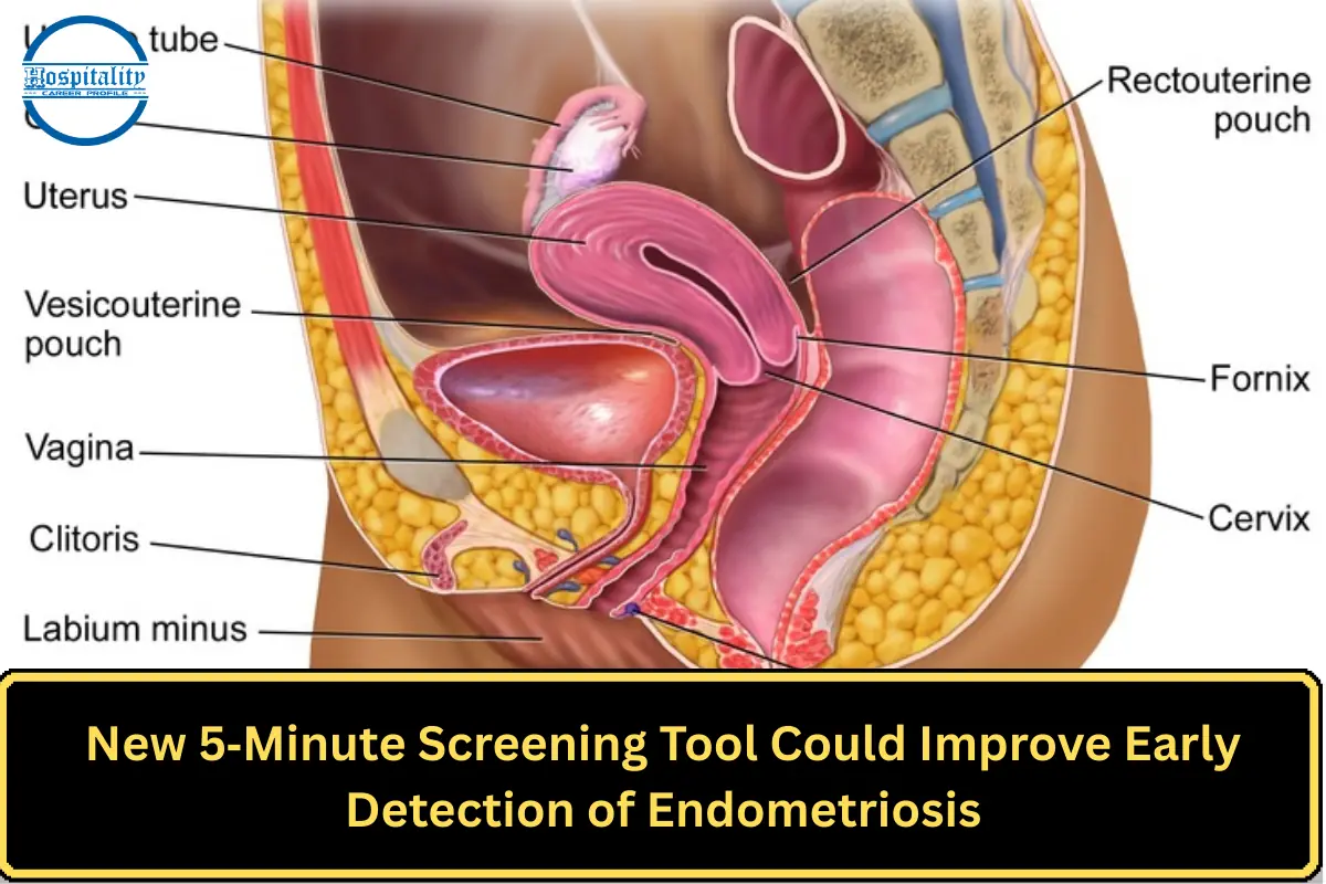 New 5‑Minute Screening Tool Could Improve Early Detection of Endometriosis