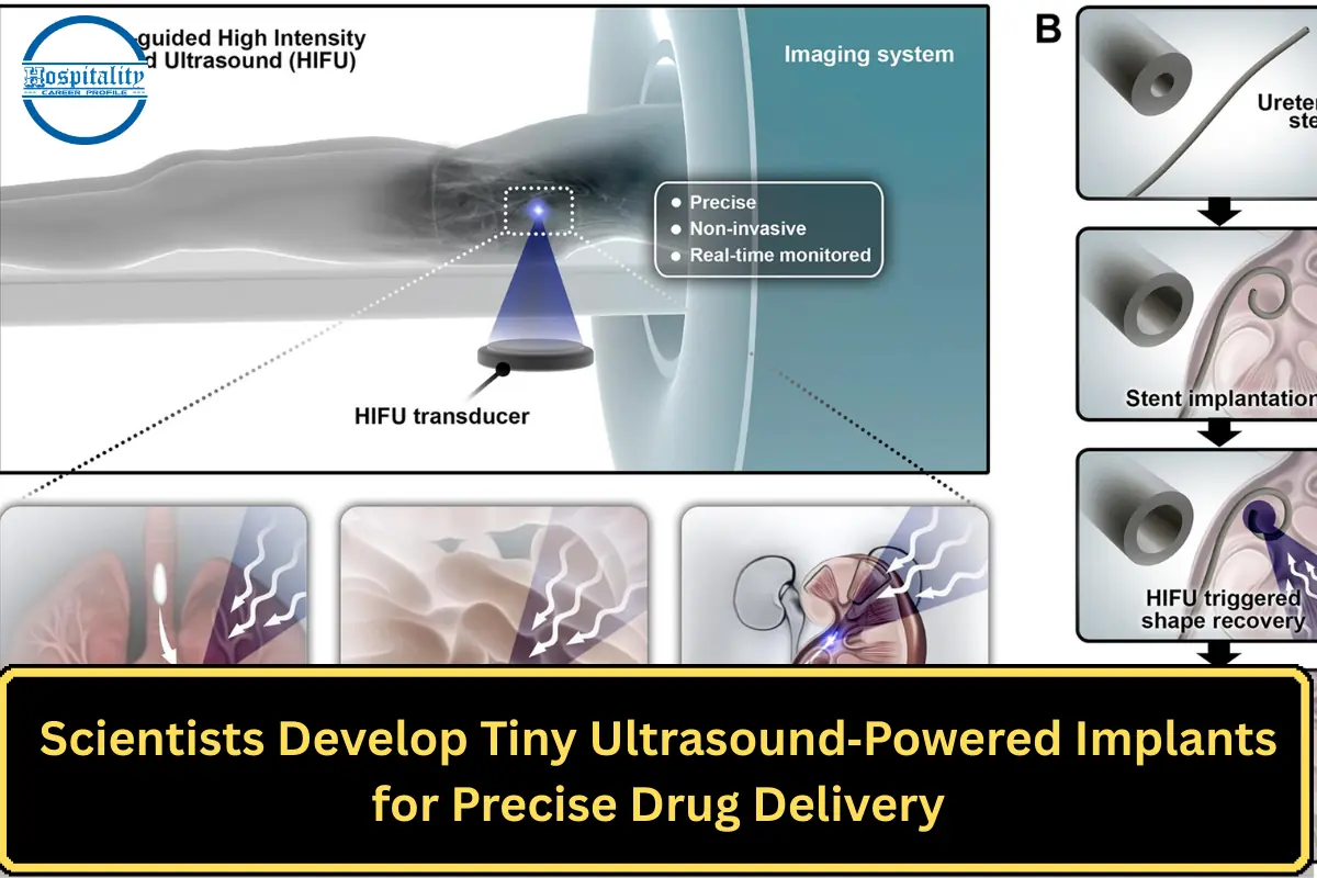 Scientists Develop Tiny Ultrasound‑Powered Implants for Precise Drug Delivery