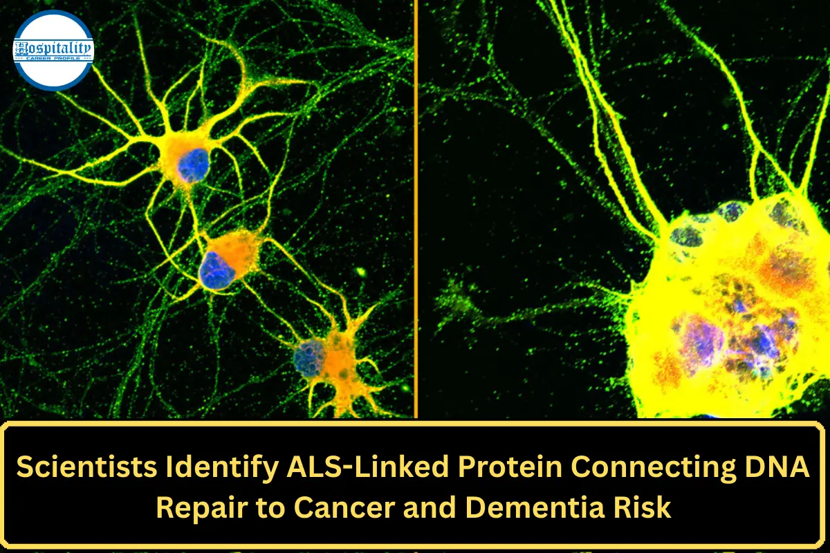Scientists Identify ALS-Linked Protein Connecting DNA Repair to Cancer and Dementia Risk