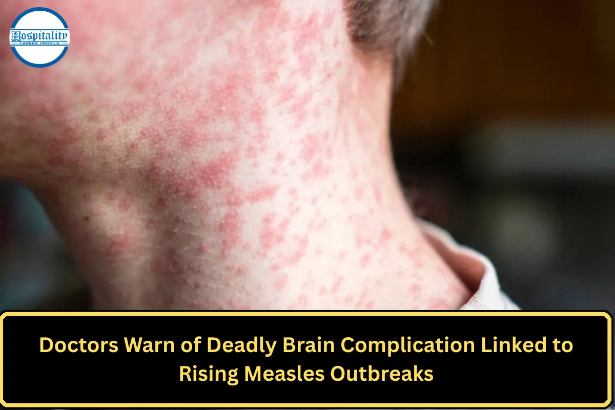 Doctors Warn of Deadly Brain Complication Linked to Rising Measles Outbreaks