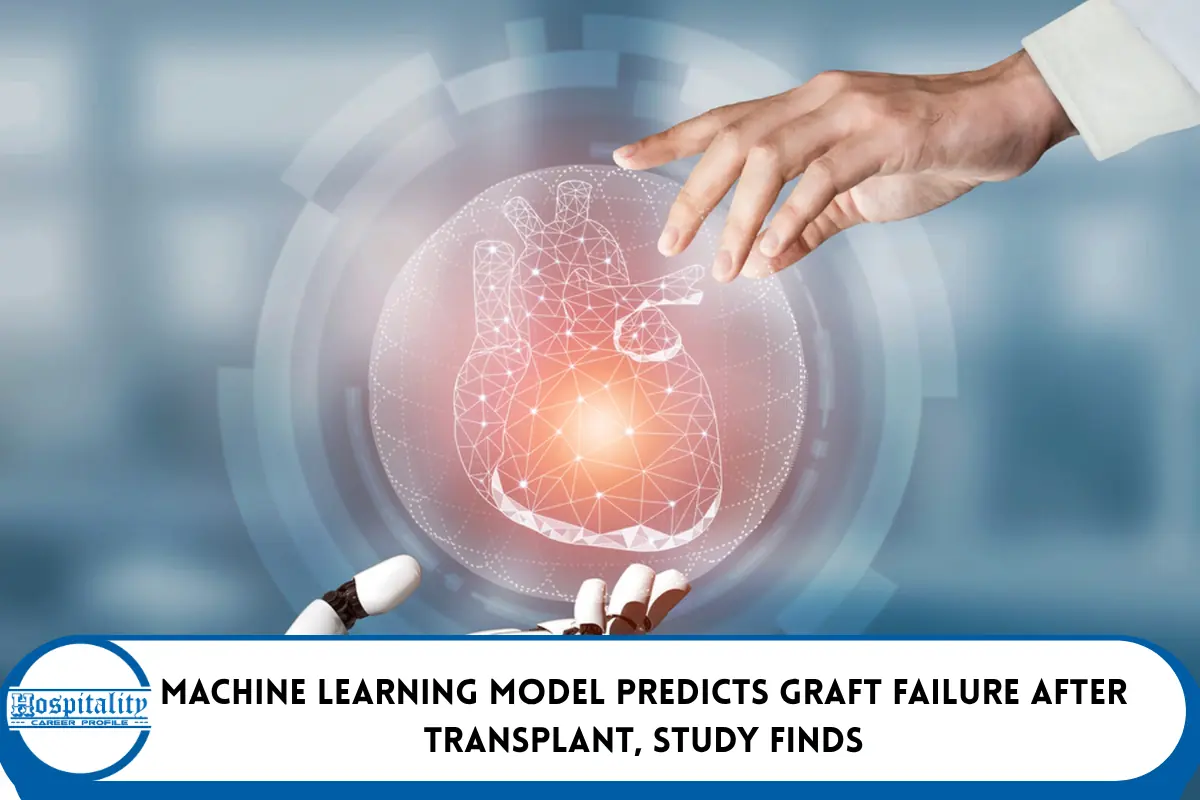 Machine Learning Model Predicts Graft Failure After Transplant, Study Finds