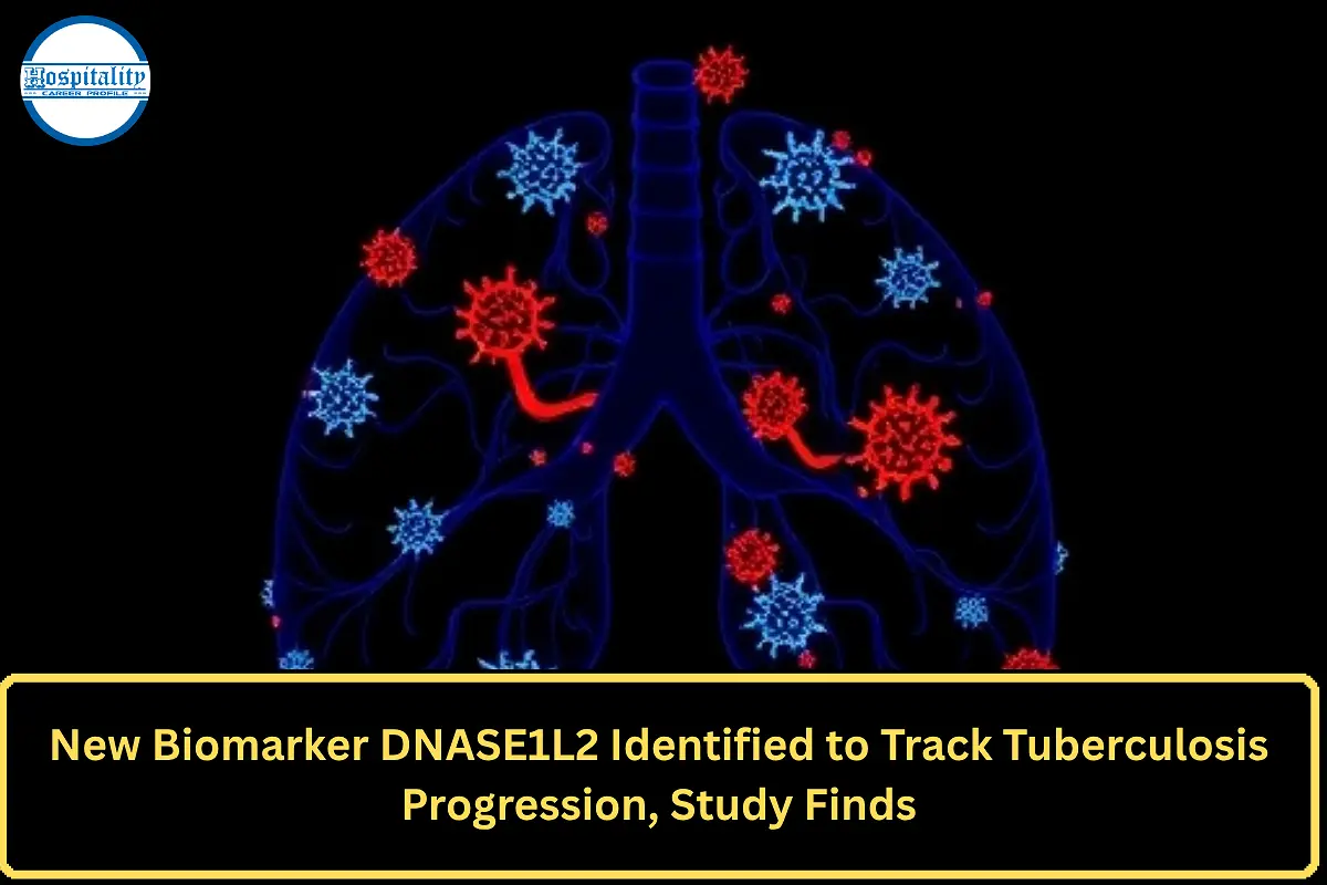 New Biomarker DNASE1L2 Identified to Track Tuberculosis Progression, Study Finds