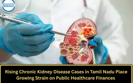 Rising Chronic Kidney Disease Cases in Tamil Nadu Place Growing Strain on Public Healthcare Finances