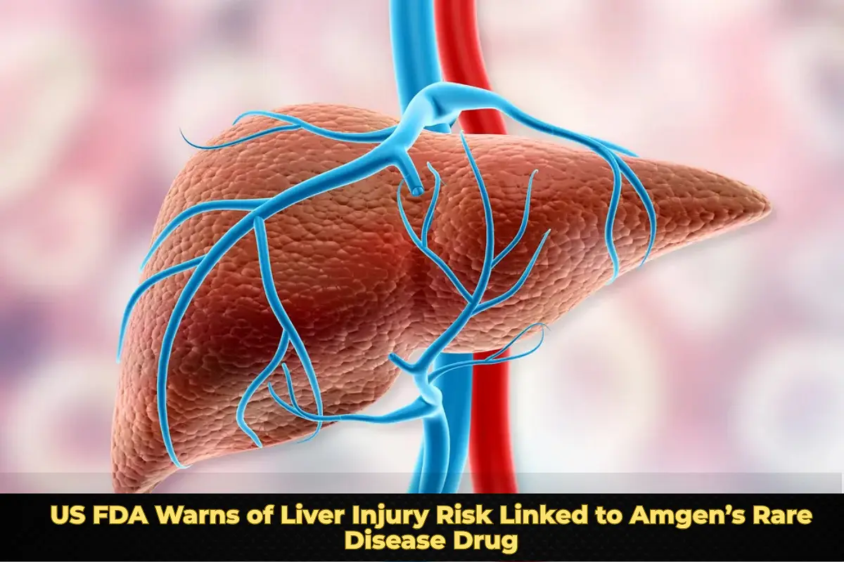 US FDA Warns of Liver Injury Risk Linked to Amgen’s Rare Disease Drug