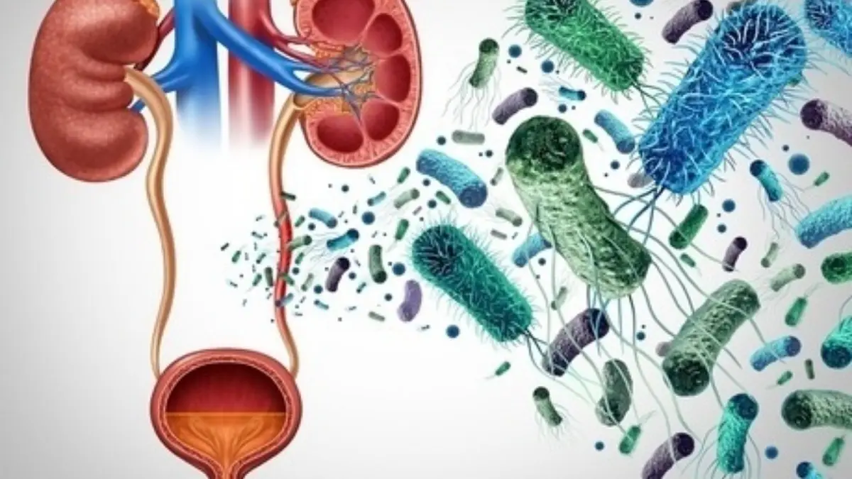 Bacterial Breakthrough Offers New Route to Early Detection of Noma Disease