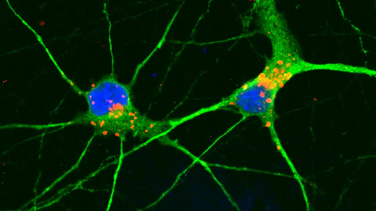 Compound Clears Cellular Waste, Protects Neurons in Dementia Model