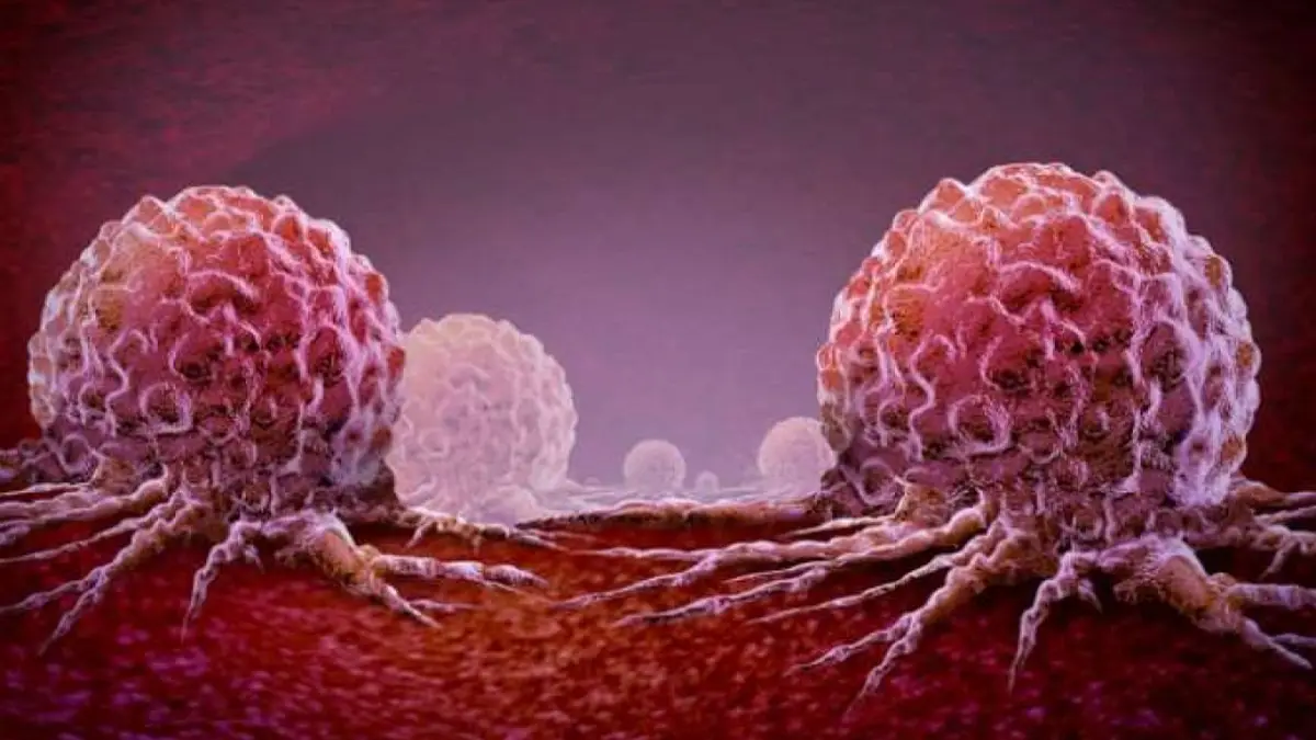 Breast Cancer Treatment Resistance Gene: Shocking Discovery